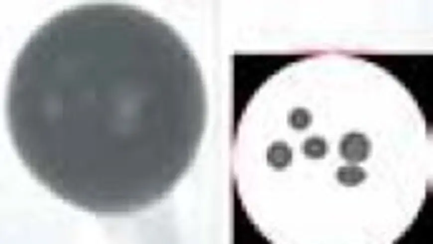2D X-RAY