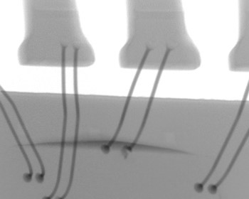 2D X-RAY