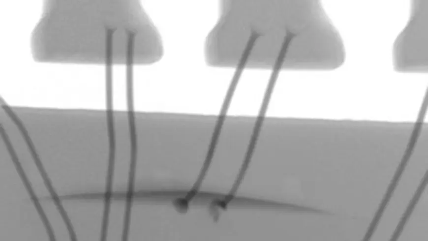2D X-RAY